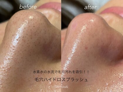 ビモアス(bimous)の写真