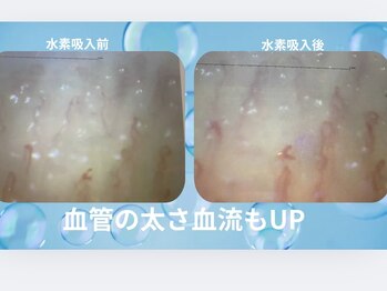 ヨサパーク すずのね(YOSA PARK)/指先の血流測定結果