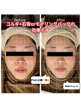 チョアチョア 立川本店(CHOA-CHOA)/痛みが少ないから続けられる☆