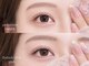 エトルカ(etorca)の写真