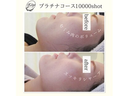 サロンドマイン ミーネイル(Salon de MiNE Mee nail)の写真