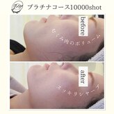 サロンドマイン ミーネイル(Salon de MiNE Mee nail)