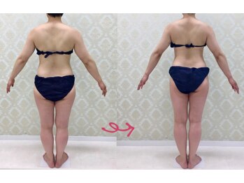 チャーム(Charm)/ヒップアップ&脚長に変化☆