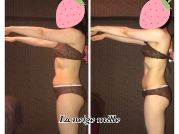 ラネージュミル(La neige mille)/インキュア痩身