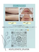 カッツエステティックサロン 東尾道/【Instagram】