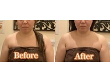 アジール 長岡リバーサイド千秋店(agir)/before/after画像