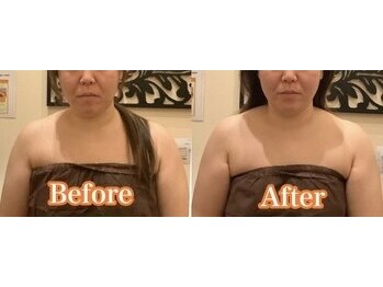 アジール 長岡リバーサイド千秋店(agir)/before/after画像
