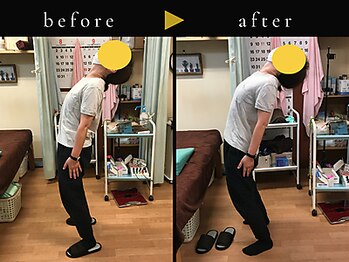 杉本接骨鍼灸院/若々しい背骨を取り戻す整体