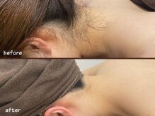 ミース 博多店の雰囲気(うなじ矯正専門サロン☆プロが自然で綺麗なうなじに仕上げます!)