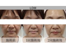 肌の奥からうるおいと弾力がよみがえる今注目のお肌ケア