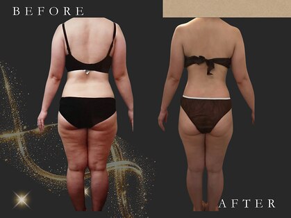 フィカス(FICUS)の写真