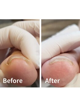 リゼラアンドコー 相模大野店/ドイツ式フットケア専門店