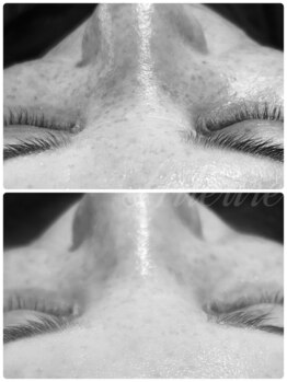 エルール トータルビューティ(Aileure total beauty)/ソフトピール×Waxフェイシャルy