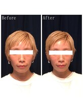 たくろう鍼灸院 豊田本院/Before＆After