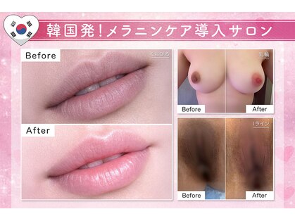 ルネル(Lunelle)の写真