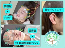 グローウィング整骨院 鍼灸院(Growing整骨院 鍼灸院)の雰囲気（美容鍼・耳ツボ・小顔矯正など美容メニューも豊富◎）