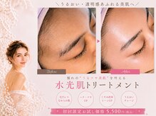 ラナ(Lana)