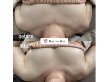 リュウ(le.lieu)/横に流れたバストも大丈夫