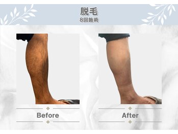 エムプラス 東戸塚(M+)/before/after