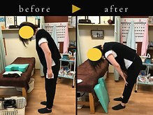 杉本接骨鍼灸院/若々しい背骨を取り戻す整体
