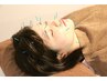 【美肌・たるみケア】美容鍼スタンダードコース　￥4000→￥2500