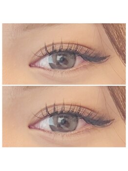 シェノン(chainon)/バインドロック