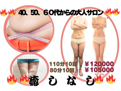 フレクシーの写真