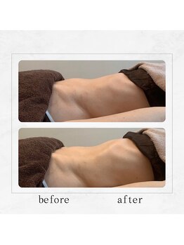 サロンドビューティー 美ふぅ(salon de beauty 美ふぅ)/お腹周り