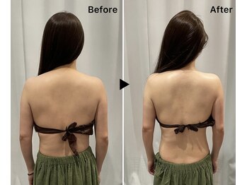 レミュー(Les mieux)/凝り解消でスッキリ姿勢美人