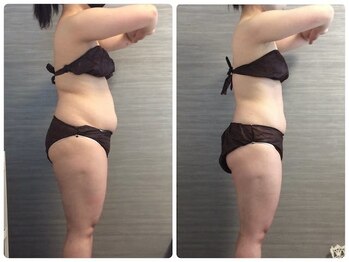 美容整体ウェリナ あま甚目寺院/小顔矯正/骨盤矯正/美脚サロン