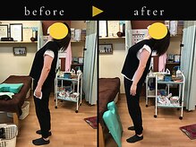 杉本接骨鍼灸院/若々しい背骨を取り戻す整体