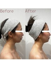 エステティックサロン ラ ベルタ(Esthetic Salon La Belta)/小顔コルギ