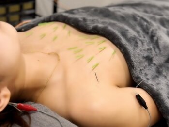 ハリスタ(HARISTA)の写真/国家資格を持った女性鍼灸師による施術で美しいバストラインに☆駅チカで通いやすさ◎