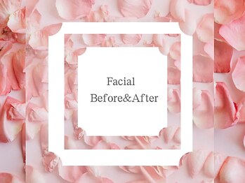 リリー ボヌール(Lily bonheur)/お客様のBefore&After