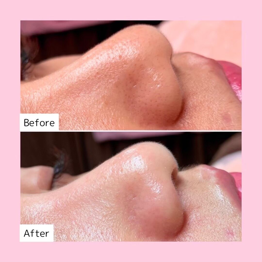 ホワイトラボ 川西(White labo)｜ホットペッパービューティー