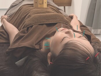 ヒノト(Hinoto)の写真/【美肌×健康の両方が叶う＊】体調ケア+お肌悩み改善!!美容鍼灸で心身を整えリラックス＆メンテナンスを◎