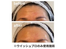 ウィッシュプロサロンケー(Wishpro salon K)の雰囲気（たった1回で深い表情皺も薄く！）