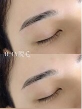 モア(Moi) 【No,4】 WAX脱毛