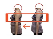 ストレートネック、巻き肩が改善したら、バストアップ◎