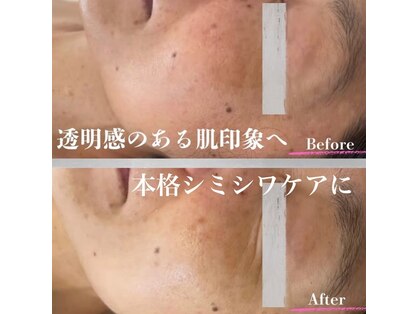 メディカルメイクサロン イマリ(imari)の写真