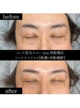 ユー 西船橋店(you)/ビフォーアフター写真