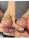 メロウ(merow)の写真/巻き爪ケアができる特殊なジェルで足元を整えませんか？痛みにお悩みの方も快適に♪