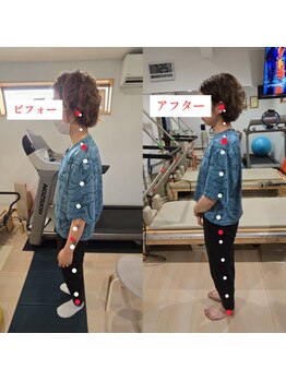 整体ピラティスウォーク/姿勢矯正