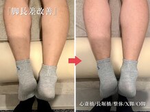アロエ鍼灸整体院/Before-After