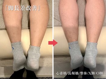 アロエ鍼灸整体院/Before-After