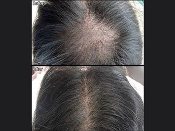 キュライム 熊本(CURAIM)/育毛促進【60代女性】