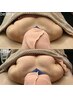 【札幌希少】削げ胸・小胸ケアふっくら上向きバストへ90分プレミアム体験!