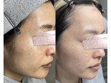 モガナ(mogana)の雰囲気（お肌の美しさまで極める、結果重視のシミケアsalon。）