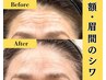 【額・眉間のシワ改善】額の老け集中×顔美容整体70分☆通常18700