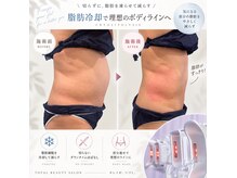 プレミドールの雰囲気(ホームケアのご相談もお任せください!#痩身#育乳#バストアップ)